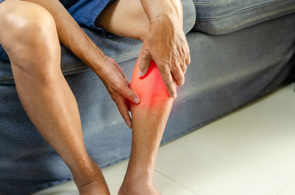 Cellulitis Signs: Causes, Symptoms, and Treatment