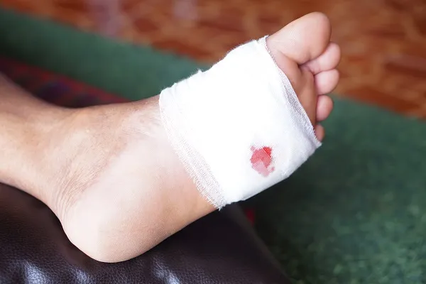 foot wound care specialist near maryland