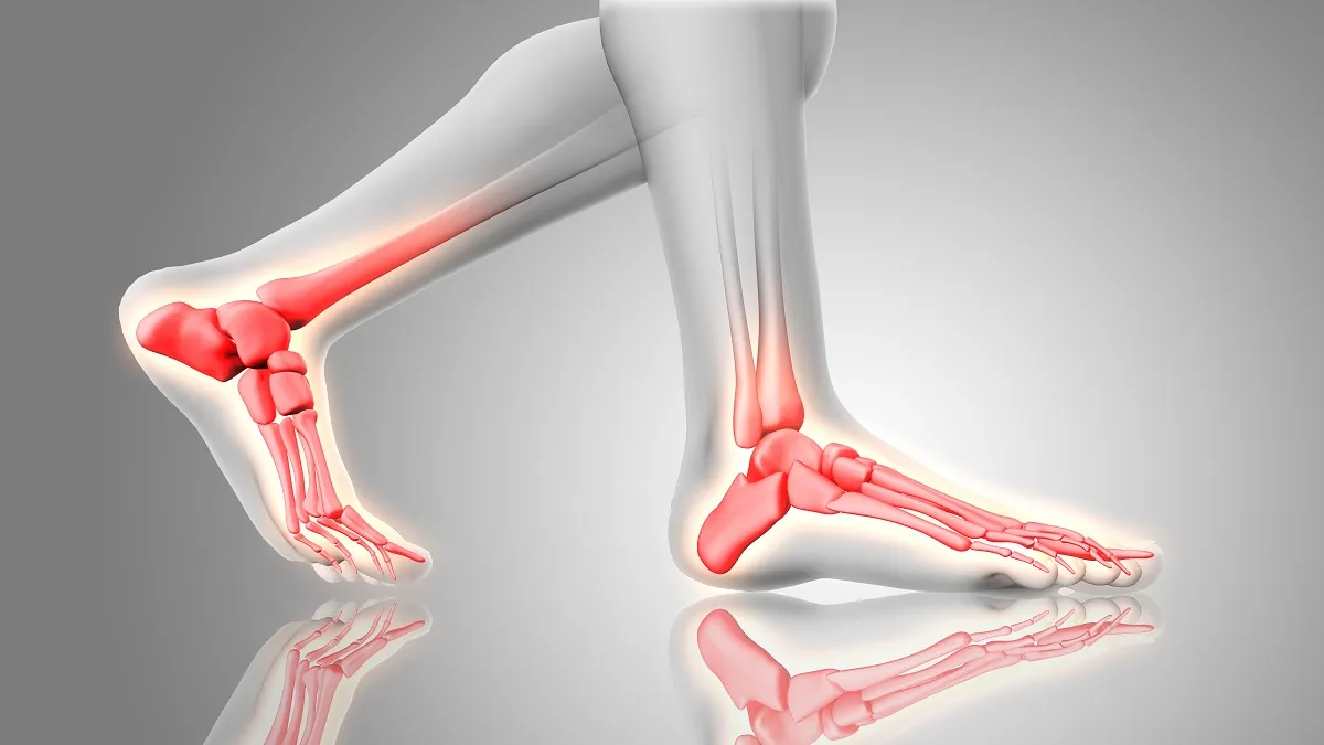 Heel and Arch Pain? Find Relief with We Treat Feet Podiatry