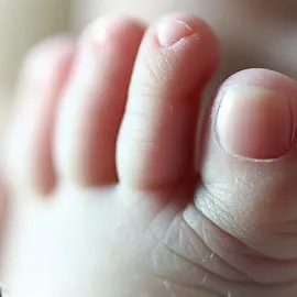 babys ingrown toenails