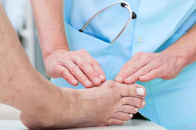 Is that my Bunion?