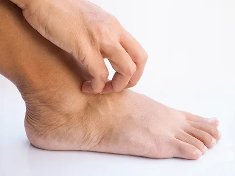 Podiatric Skin Disorders
