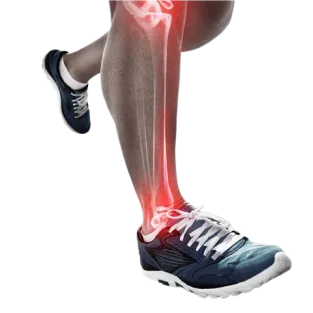 Sports Injuries