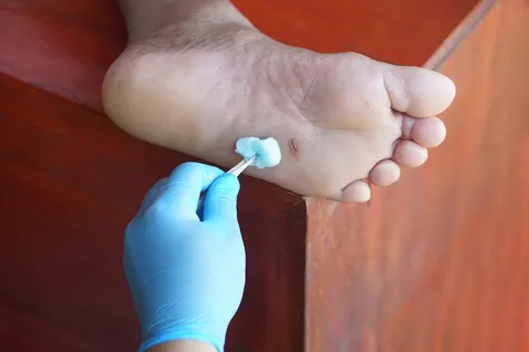 Wound Care
