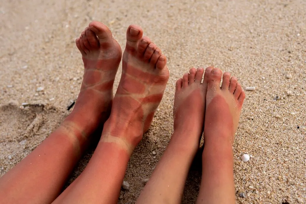 Podiatric Skin Disorders