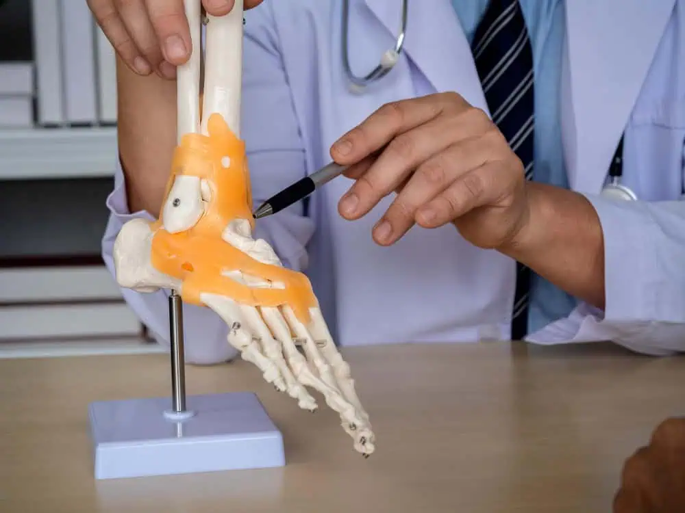 MBA Subtalar Arthroereisis Overview
