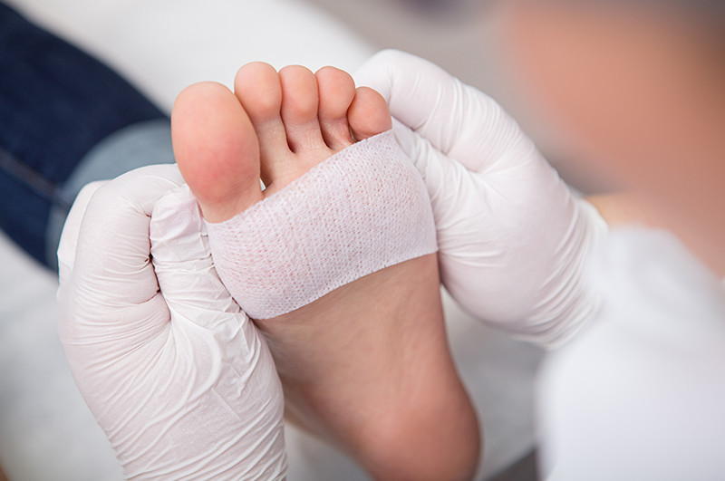 we treat feet doctor treating the ankle wounds