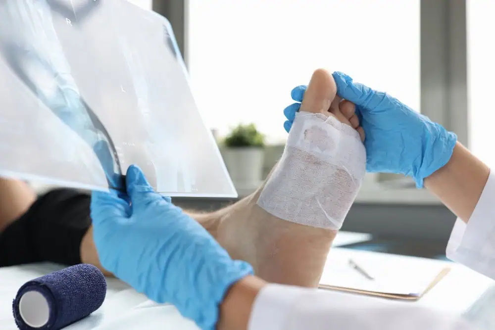 diabetic foot complications