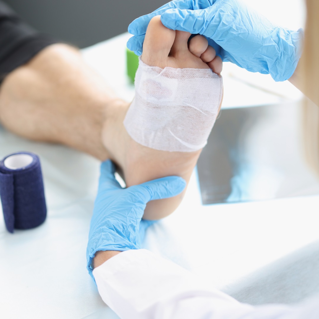 wound care diabetic foot skin graft at WeTreatFeet