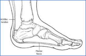 heel pain