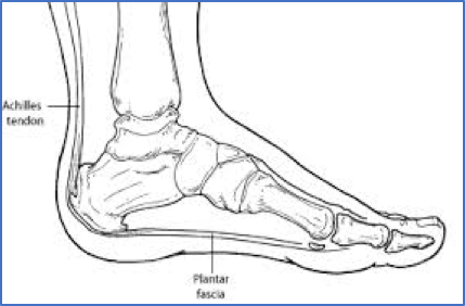 heel pain