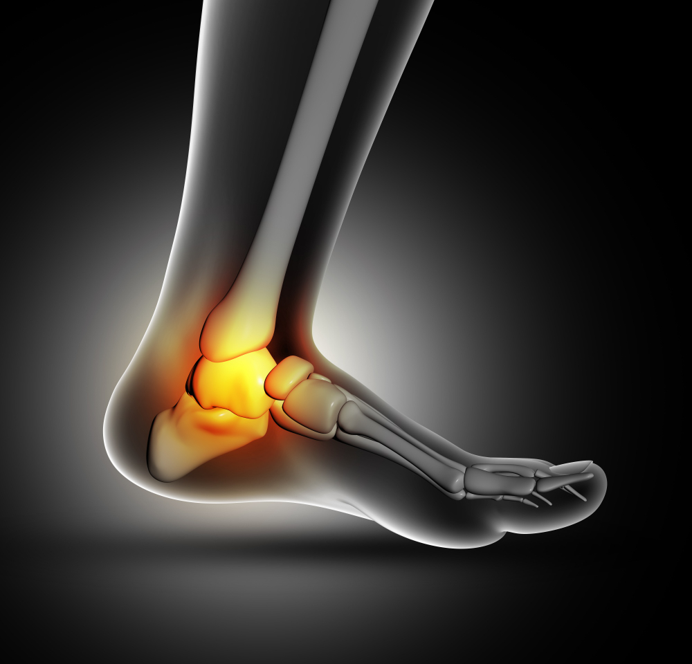 osteochondral lesions of the talus