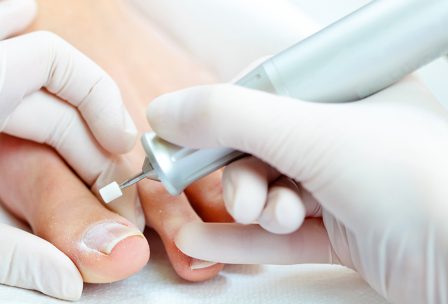 The KeryFlex Nail Restoration System