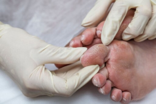 A podiatrist examining a diabetic patient's foot during a routine check-up at WeTreatFeet Podiatry Diabetic foot care Amputation prevention Diabetic foot ulcers Peripheral neuropathy Wound care specialist Custom orthotics for diabetes Diabetic foot screening Advanced podiatry treatments