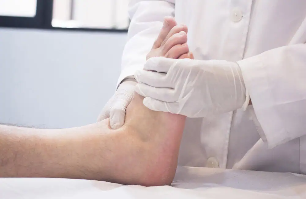 podiatrist examines patients foot preventing limb and foot complications